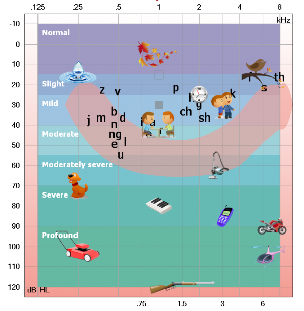 Audiogram